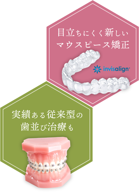 目立ちにくく新しいマウスピース矯正 実績ある従来型の歯並び治療も